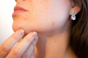 Woman with sore throat